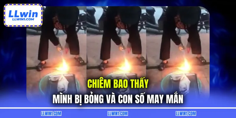 Chiêm bao thấy mình bị bỏng và con số may mắn